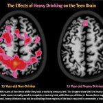 affect of heavy drinking brain development